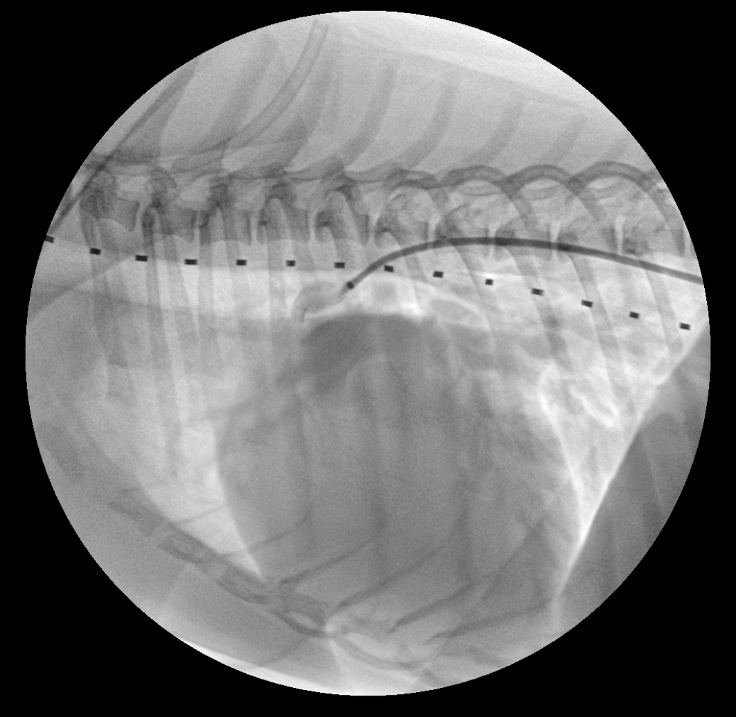PDA 시술 투시 영상 1